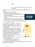 ECG - Guide - Interpretation - Ttoubles Du Rythme