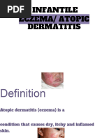 Eczema Atopic