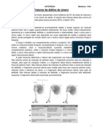 Fraturas Da Diáfise Do Úmero - Resumo Ortopedia Medicina