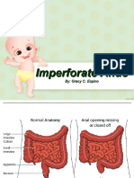 Imperforate Anus