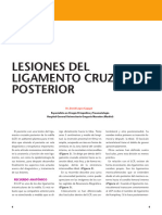 David Lopez Capape - Lesiones Del Ligamento Cruzado Posterior