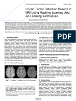 A Survey On Brain Tumor Detection Based