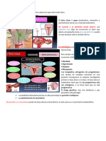 Cáncer de Endometrio