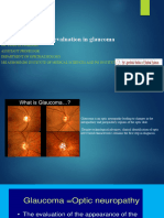 Optic Disc Evaluation