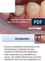 Mucosite Périimplantaire