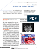 Challenges of A Large Cervical Fibroid in Pregnancy