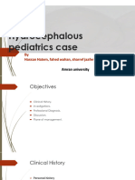 Case Study of Hydrocephalus of Pediatrics