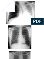 X RAYS Final