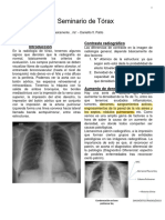06 - Seminario Tórax Transcri OK