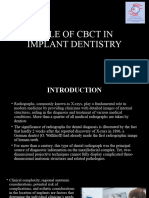 Role of CBCT in Implant Dentistry