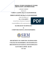 Multi-Modal Fusion For Brain Tumor Segmentation and Prognosis