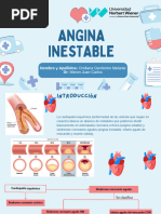 Angina Inestable