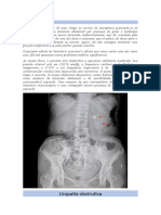 4-Uropatia Obstrutiva