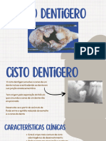 Cisto Dentigero