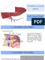 Trombosis Venosa Portal Radiologia