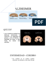 2.3 Alzheimer