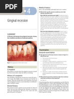 4-Gingival Recession