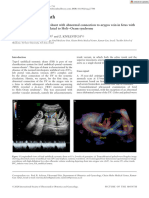 Ultrasound in Obstet Gyne - 2024 - Achiron - Type I Umbilical Systemic Shunt With Abnormal Connection To Azygos Vein in