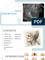 Residual Ridge Resorption: Asha C S, Second Year Mds