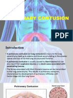 Pulmonary Contusion