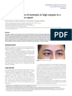 A Rare Presentation of Esotropia in High Myopia in A Young Adult