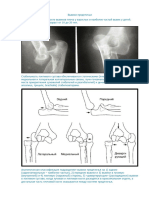 Вывихи предплечья