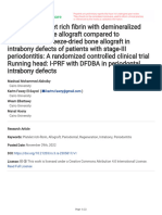 Injectable Platelet Rich Fibrin With Demineralized