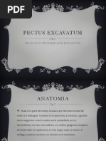 Pectus Excavatum