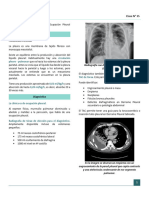 Derrame Pleural