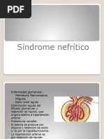 Sindrome Nefritico