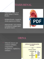 Litiasis Renal