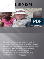 Albinism