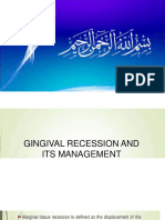 Gingival Recession