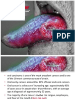 Oral Cancer: "The Forgotten Disease"