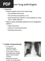 Common Lung Pathologies: Pneumonia