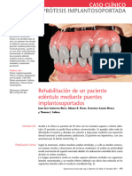 Prótesis Implantosoportada: Caso Clínico