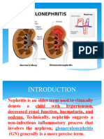 Nephritis