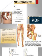 Nervio Ciatico Anatomia