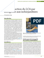 Chapitre 24 - Reconstruction Du LCA Par Autogreffe Au - 2023 - L Arthroscopie Du