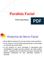 Paralisia Facial