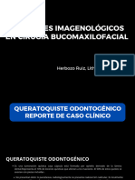 Apoyo de Imagenes Radiográficas y Tomográficas en Ciirugía Bucomaxilofacial