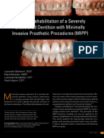 Esthetic Rehabilitation of A Severely Discolored Dentition With Minimally Invasive Prosthetic Procedures (MIPP)