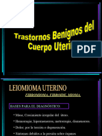 Tumores Cuerpo Uterino