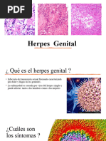 Herpes Genital