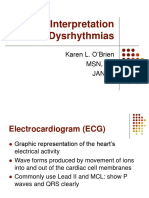 ECG Interpretation and Dysrhythmias: Karen L. O'Brien MSN, RN JAN 07