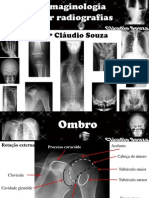 Aula 2 Imaginologia Por Radiografias - Ombro e Cintura Escapular. Profº Claudio Souza