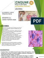 LEUCEMIA 