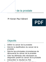 Cancer de La Prostate KPG (2h)