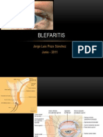 Blefaritis Oftalmosalud