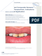 Copia de Prefabricated Composite Veneers Historical Perspectives Indications and Clinical Application